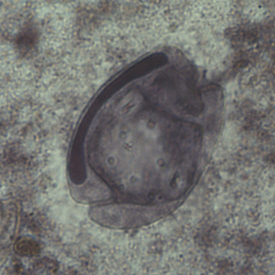 bachořec Entodinium longinucleatum